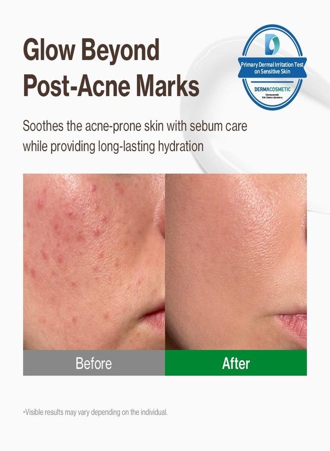يومو كريم YUMU Cica Exosome Zinc Blemish Relief Cream، مرطب للوجه للبشرة الحساسة والمعرضة لحب الشباب، خفيف الوزن، يعالج البثور، يصلح حاجز البشرة، يرطب، مهدئ، خالٍ من الزيوت، عناية بالبشرة كورية (80 مل/2.70 أونصة سائلة). - Image 2